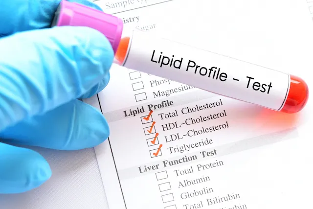 Managing Dyslipidemia: Improve Your Cholesterol and Triglycerides