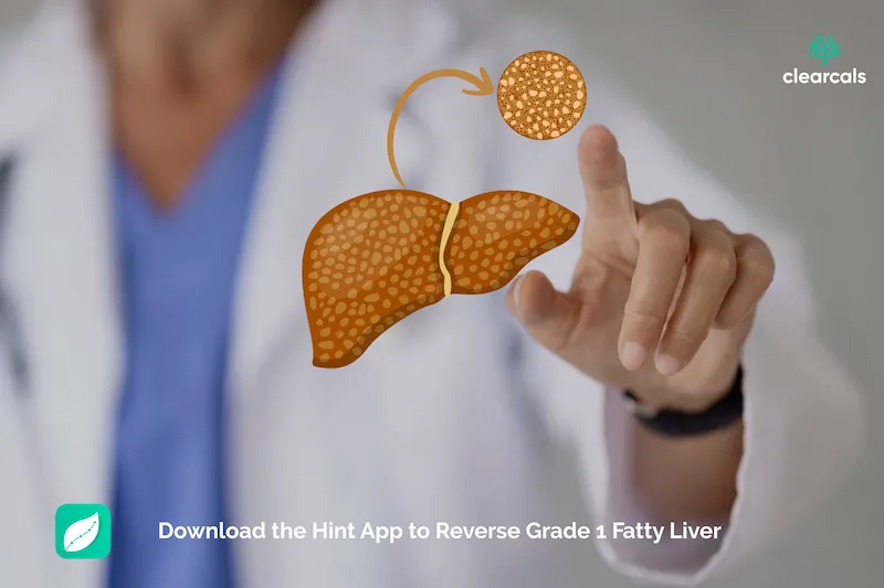 Grade 2 Fatty Liver: Symptoms, Dangers & How to Reverse It