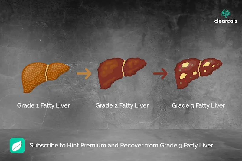 Grade 3 Fatty Liver: Symptoms, Risks, Recovery Time & Treatment