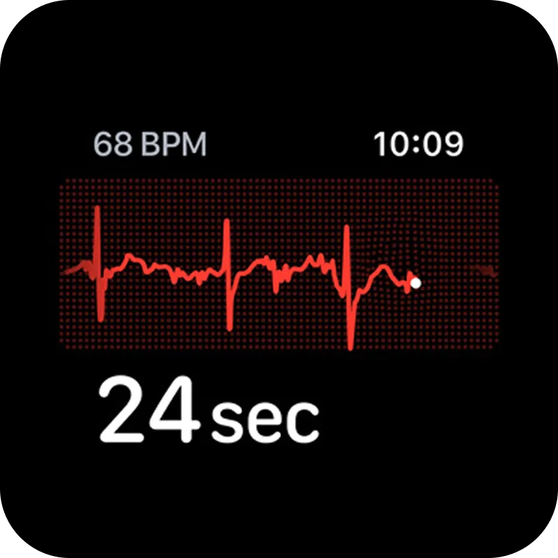 Apple-Watch-Ultra-3-Health-ECG